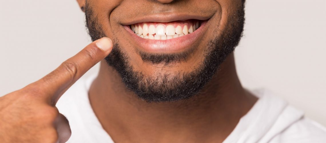 Close Up Of Biracial Man Show White Healthy Teeth